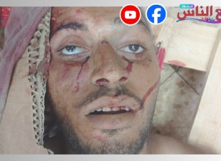 بالصور وصول شاب مجهول الهوية إلى مشرحة مجمع ناصر الطبى